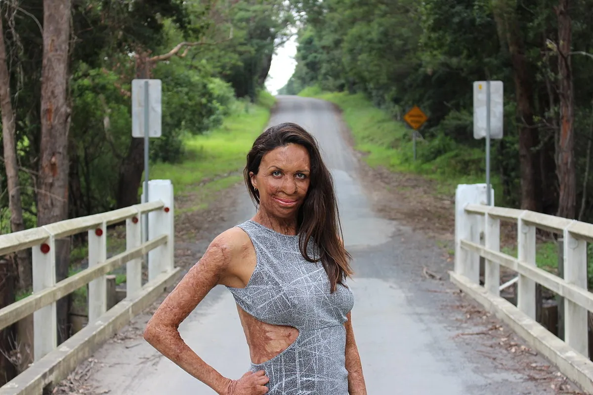 1200px-Turia_Pitt_2018