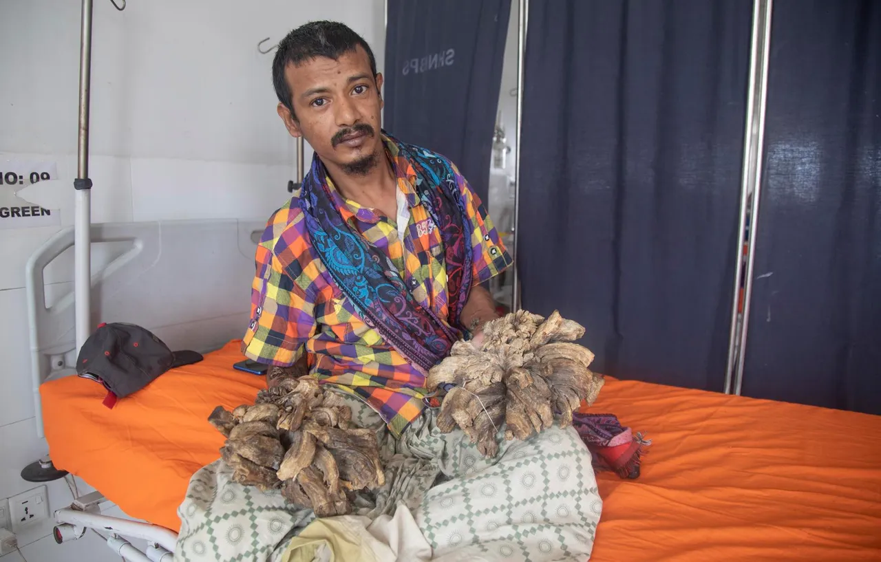 Bangladesh&#8217;s &#8216;tree man&#8217; is back in hospital