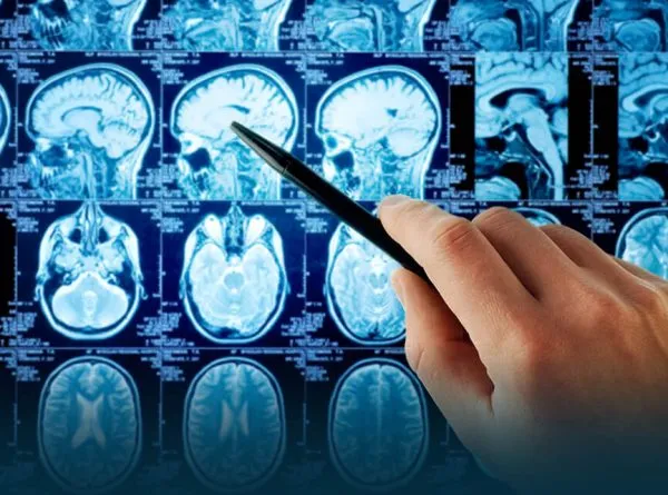 CEREBRO