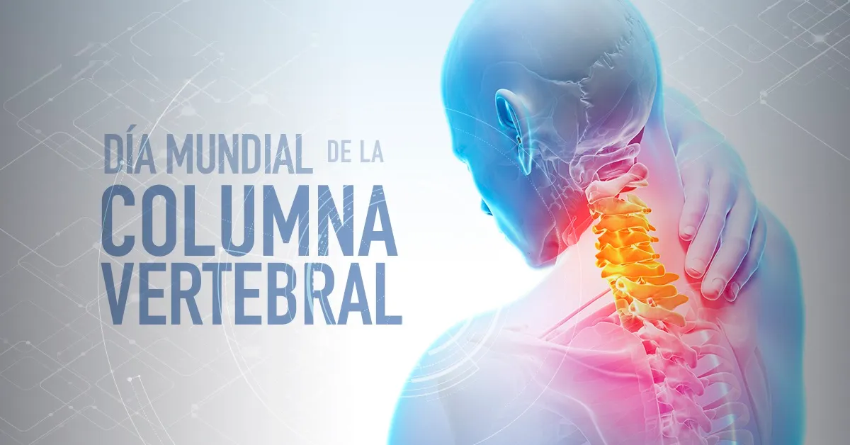 COLUMNA