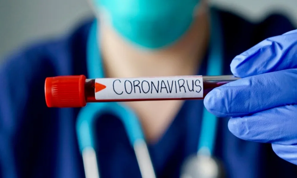 CORONAVIRUS