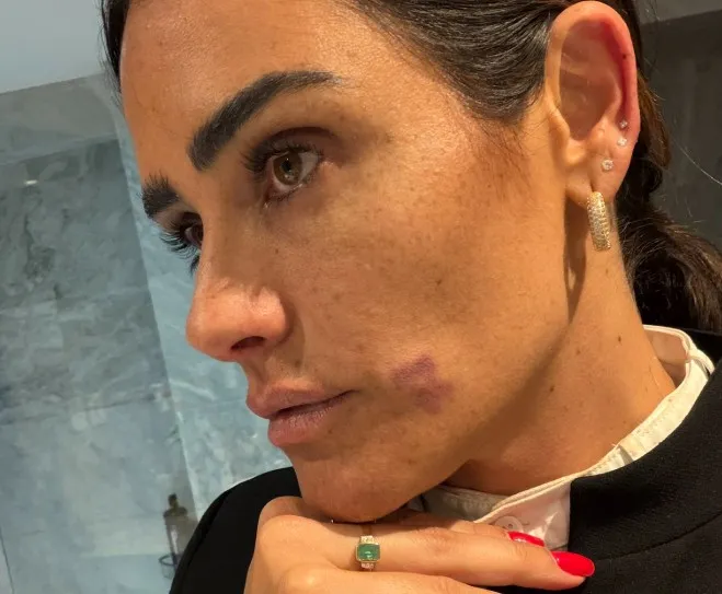 PAN CDMX respalda a Alessandra Rojo de la Vega tras agresión durante operativo en Zona Rosa