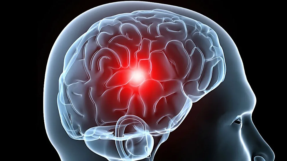 CEREBRO CABEZA
