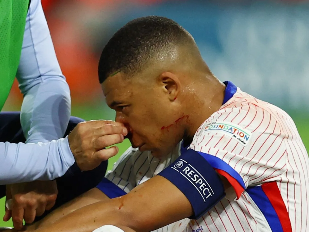 Mbappe Nariz