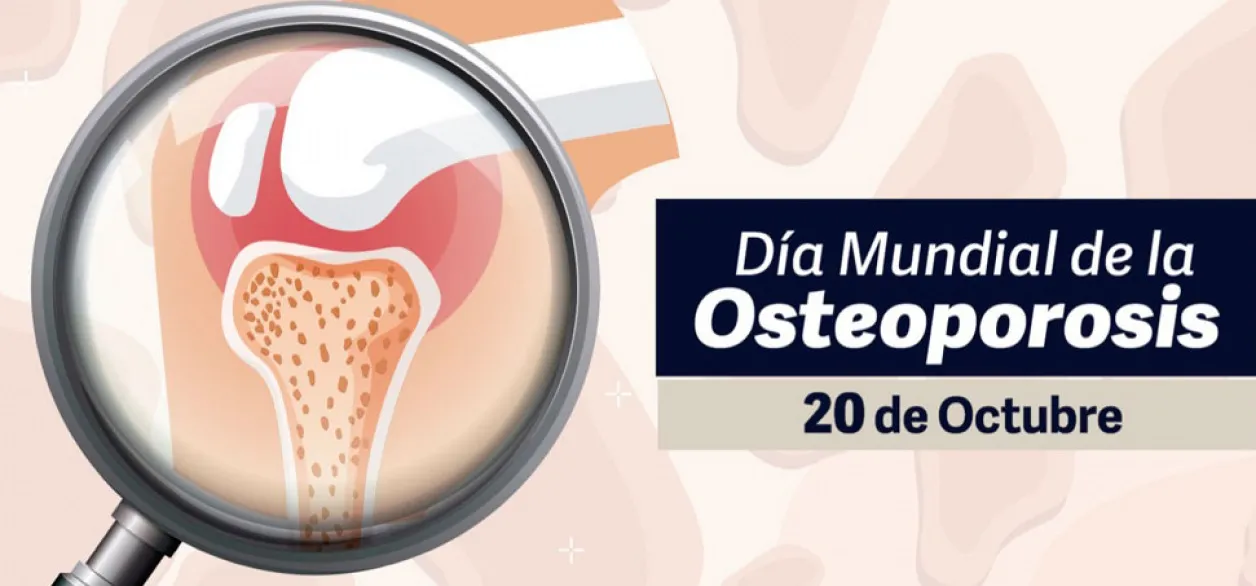 OSTEOPORISIS