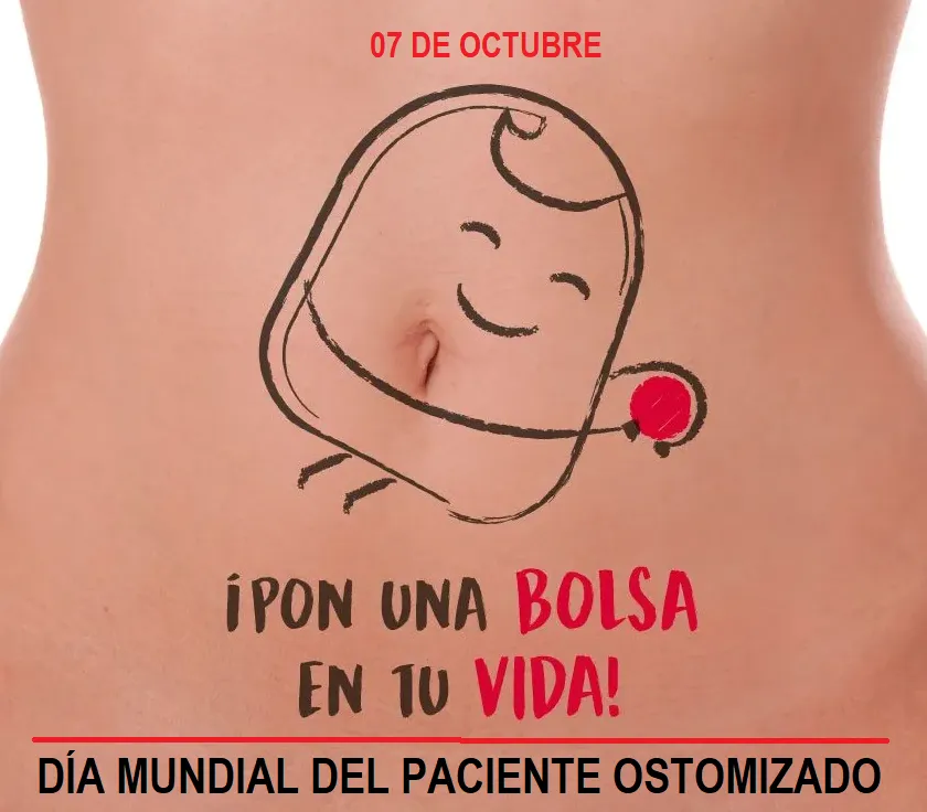 OSTOMIZADOOOOOOO