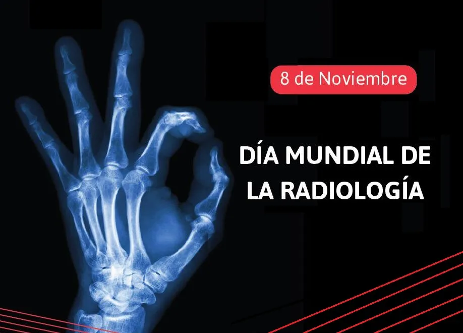 RADIOLO