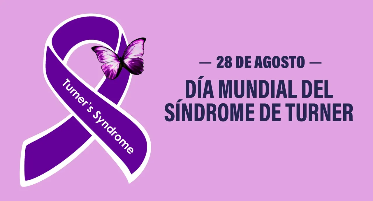 SINDROME DE TURNER