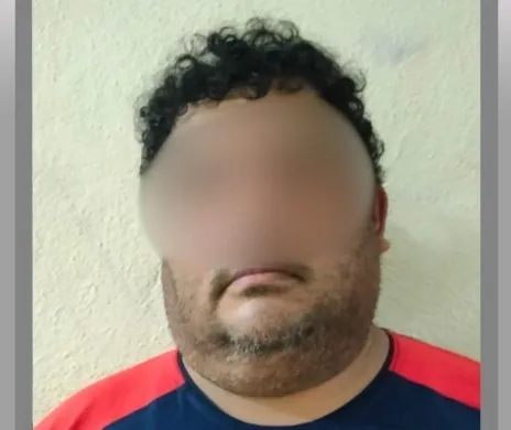 Justicia para &#8220;Tobi&#8221;: Hombre es vinculado a proceso por maltrato animal