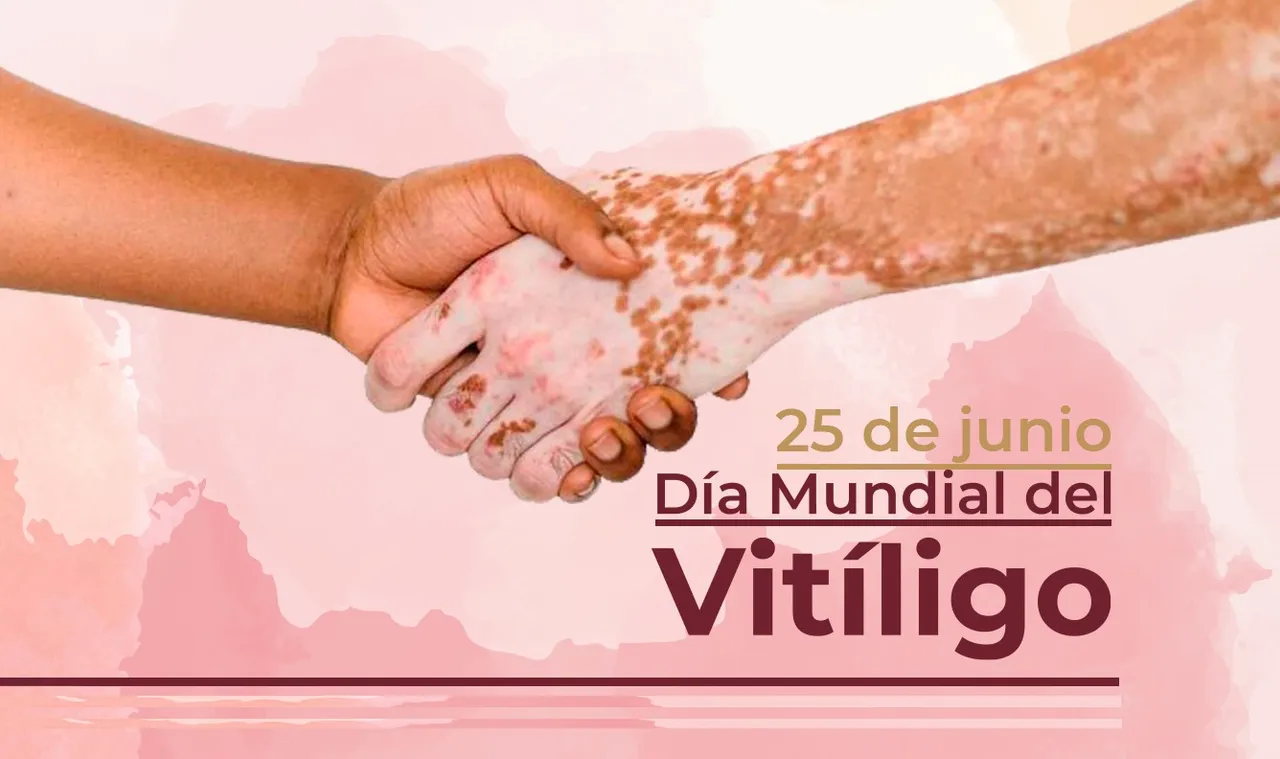 Día Mundial del Vitíligo