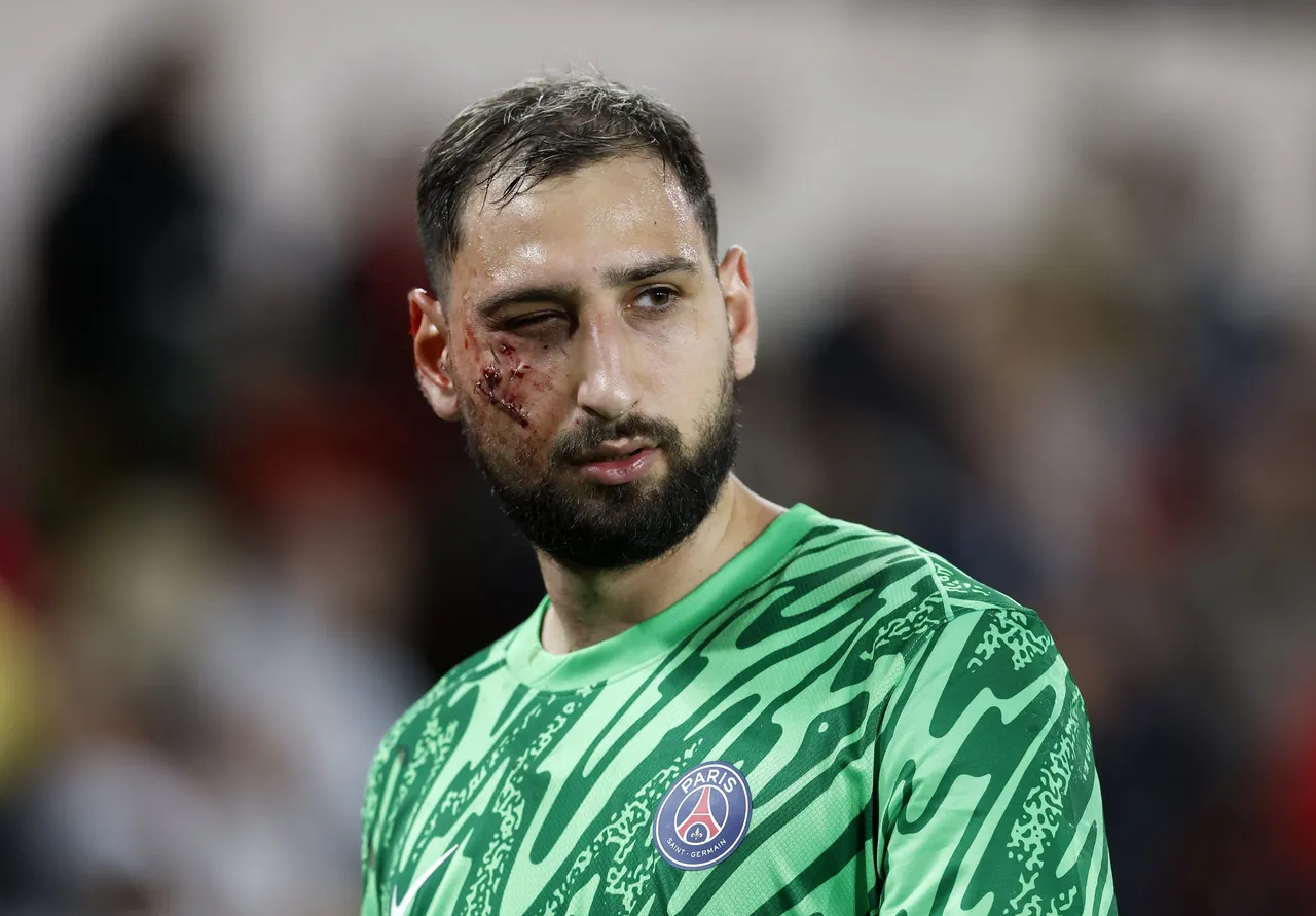 Ligue 1 &#8211; AS Monaco vs PSG