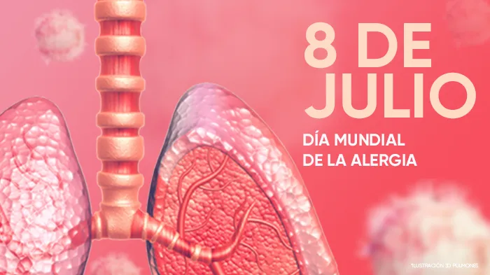 alergia