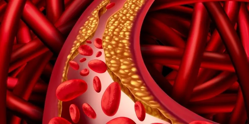 arterias