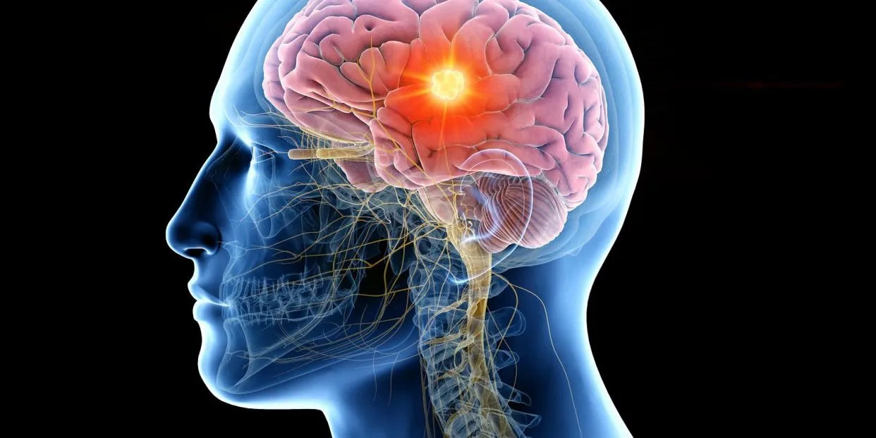 cerebro