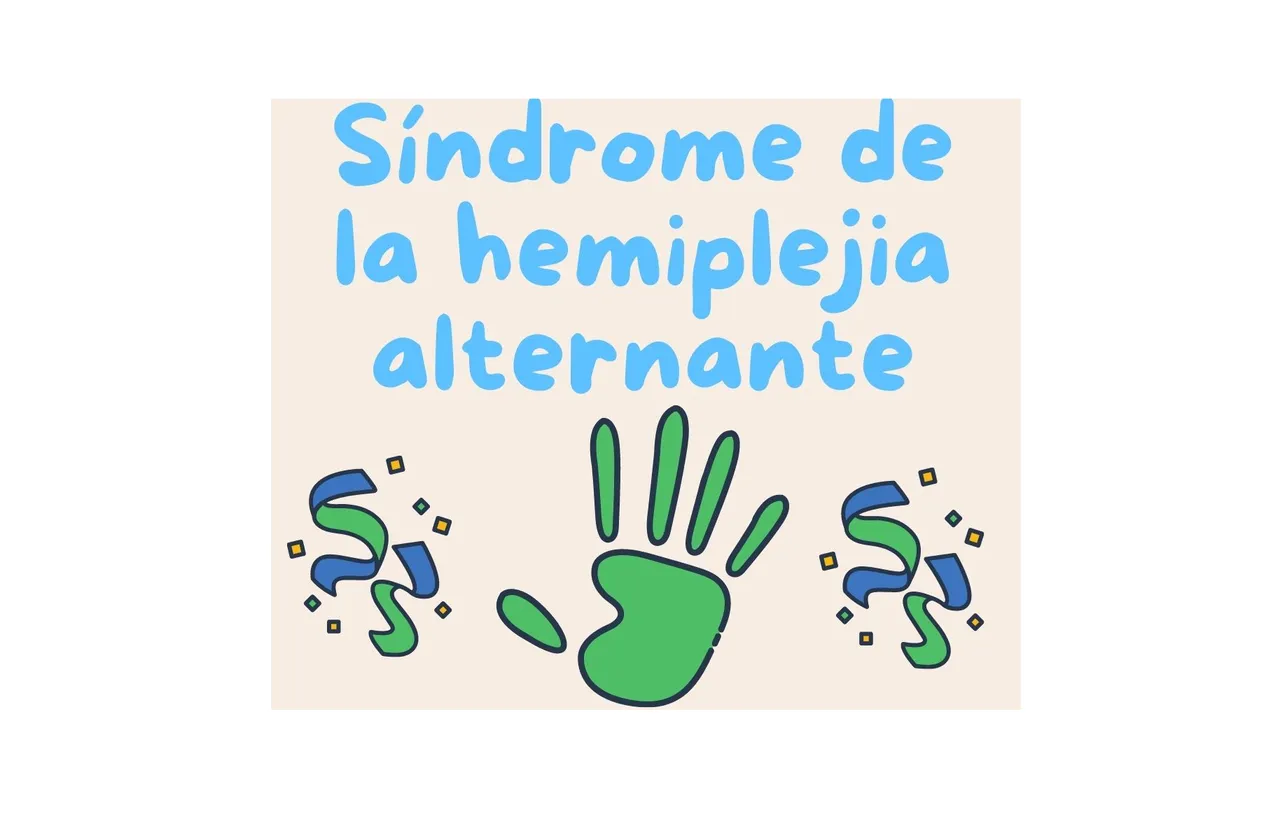 hemiplejia alternante