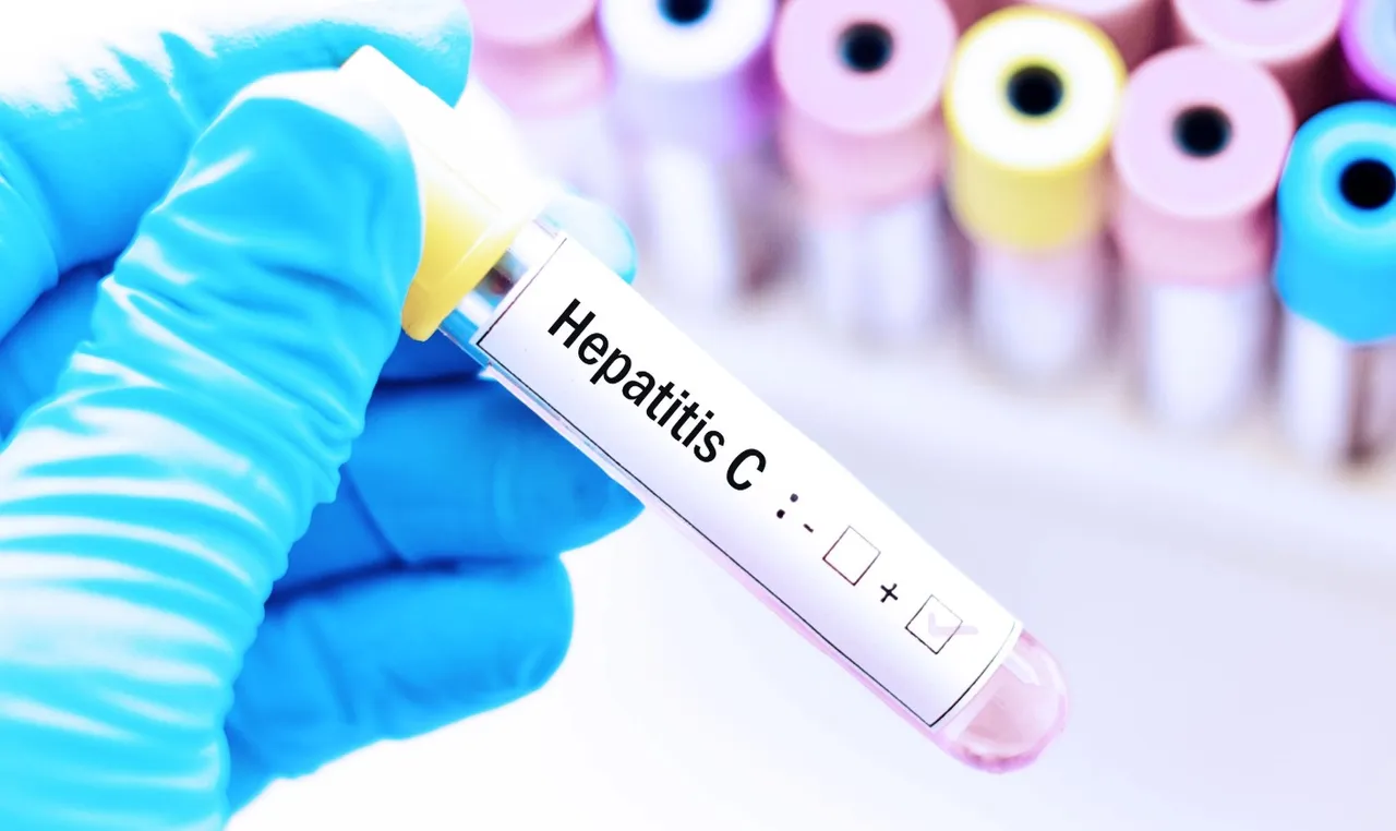 hepatitis