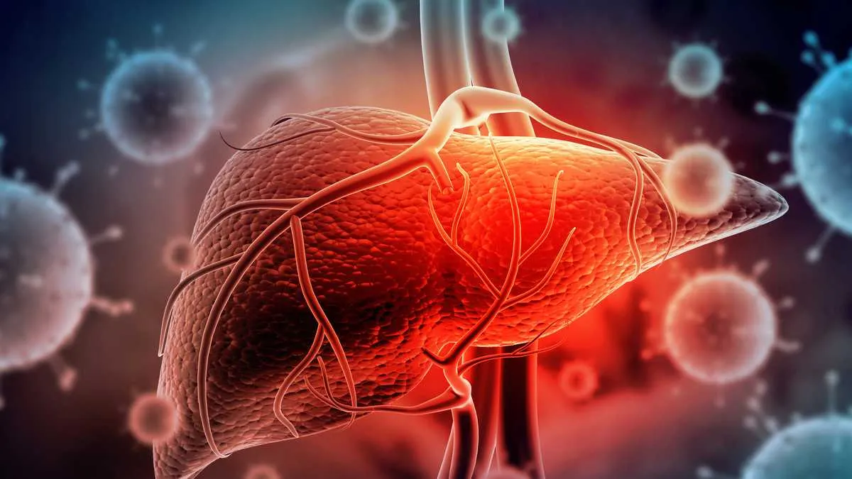 hepatitis
