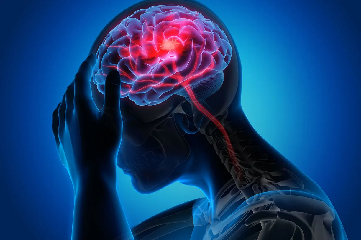 infartos