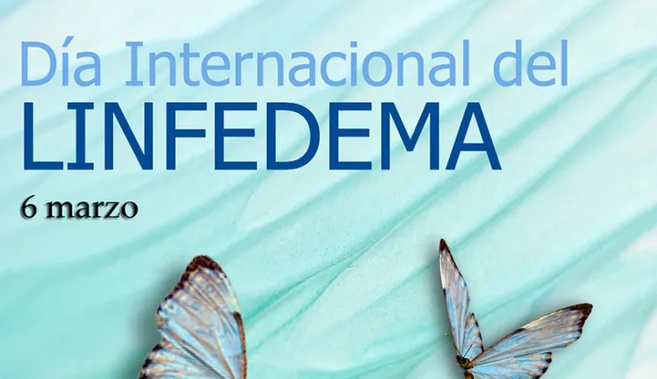 linfedema