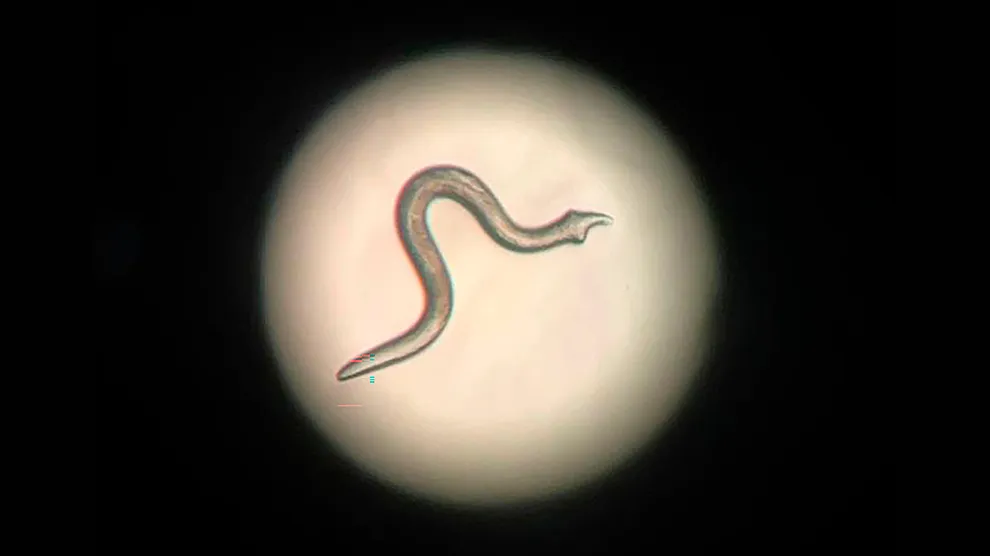 molécula obesidad