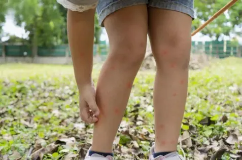 El dengue es una enfermedad viral transmitida por el mosquito Aedes aegypti
